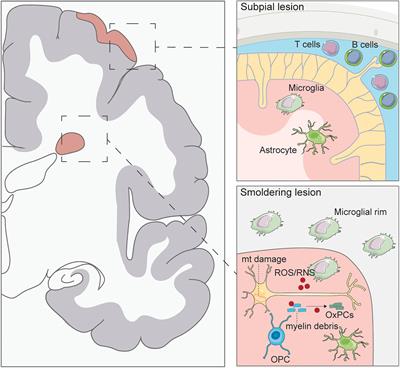 Frontiers Stem Cell Therapies for Progressive Multiple Sclerosis